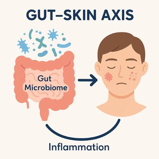 How Does Your Gut Health Affect Your Skin?