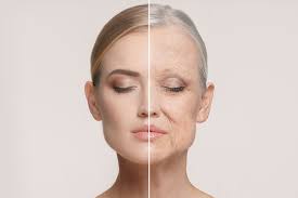 Aging Skin treatment concern