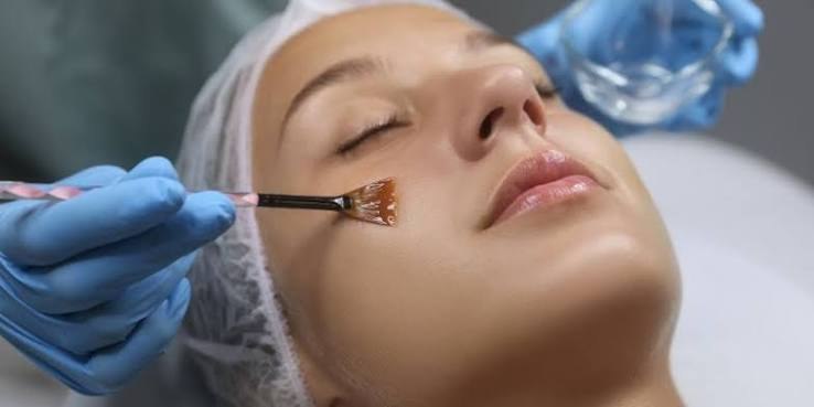 Chemical peel treatment being applied as part of a pigmentation treatment plan