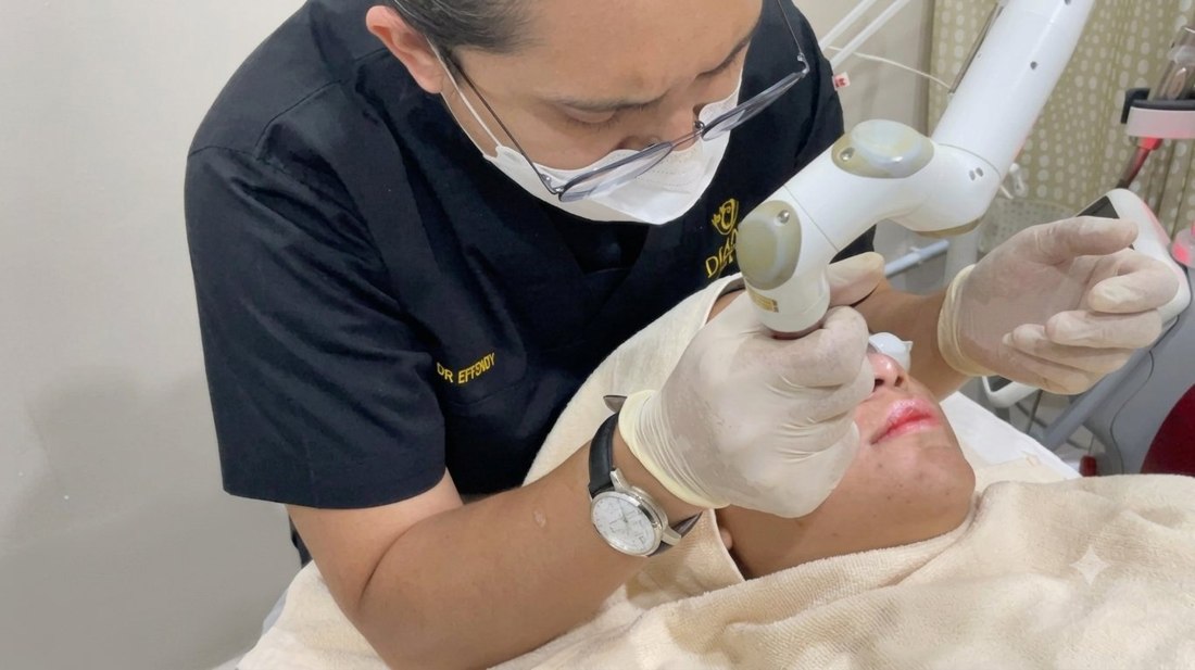 Dr Effendy performing PICO laser treatment for pigmentation at Klinik Dr Diana